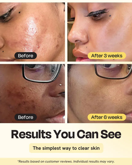 Jumbo Vitamin C Clay Mask