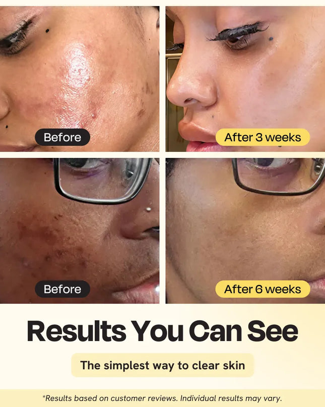 Jumbo Vitamin C Clay Mask