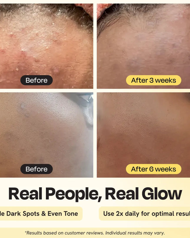 Advanced Brightening Moisturizer